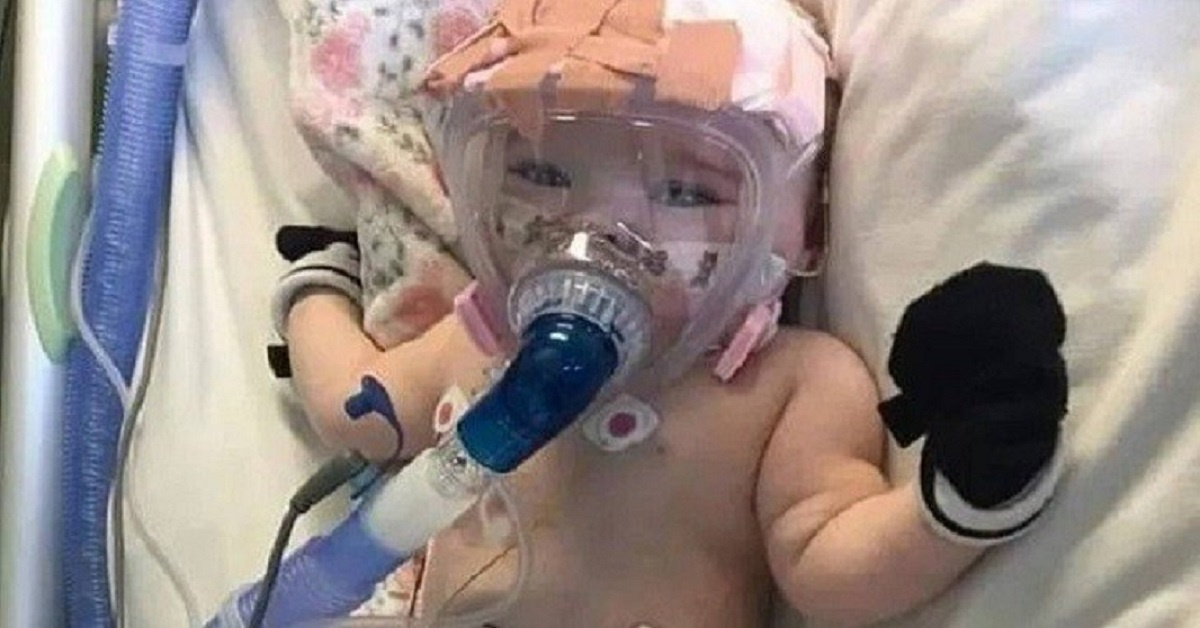 Bebê de 6 meses infectada por covid-19 luta pela sobrevivência