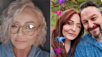 Fotos da mulher que perdeu parte do rosto - Divulgao Facebook Donna Marie Corden