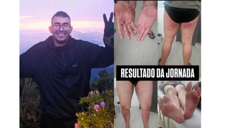 Image: https://thefolha.news/wp-content/uploads/2026/01/postiimg-695fc536a3d445477.jpg Irm exibe ferimento do jovem - ReproduoRedes sociais