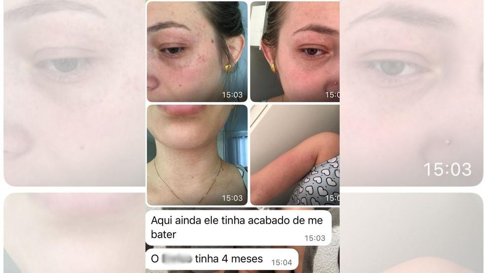 Image: https://thefolha.news/wp-content/uploads/2026/02/postiimg-69a090c6a782f2286.jpg Vtima de feminicdio relatou histrico de agresses de ex-companheiro Foto Arquivo Pessoal