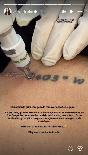 Carol Peixinho mostra processo de remoo de tatuagem aps 11 anos - Foto Instagram